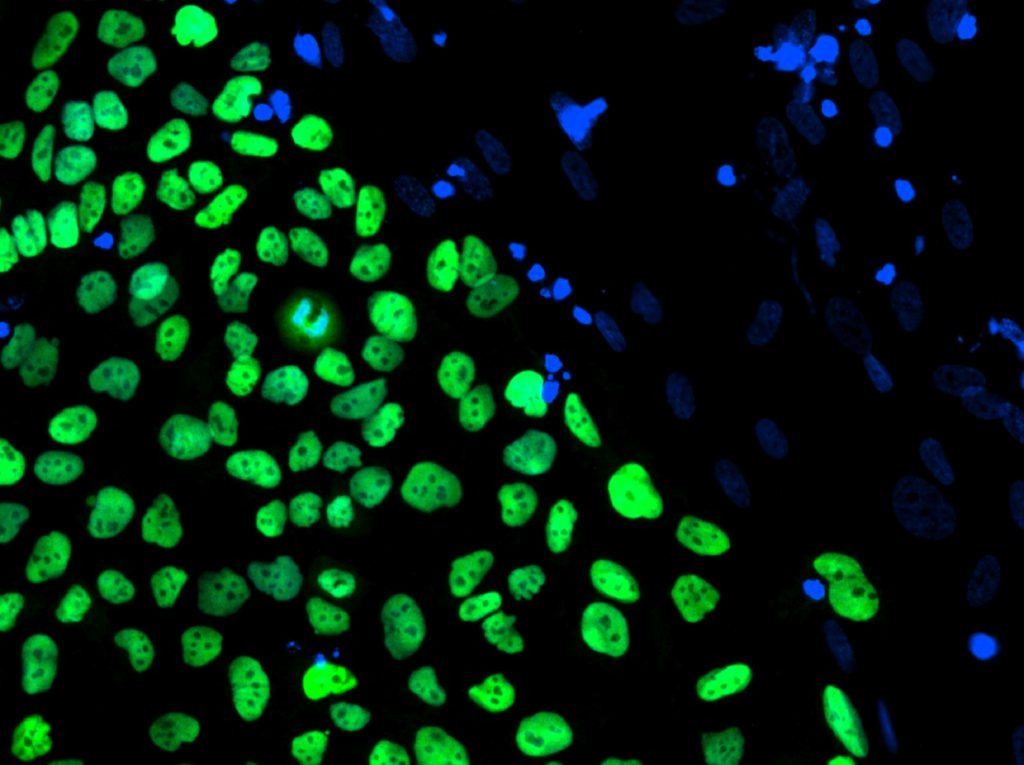 human-embryonic-stem-cell-line