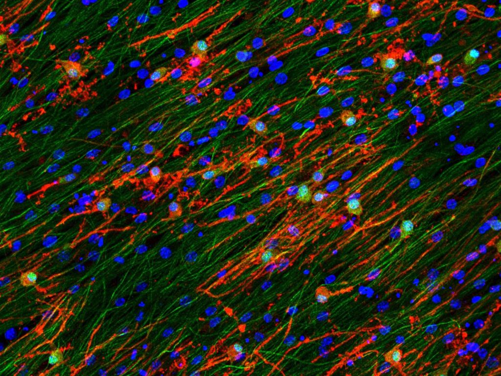 10divdrgdapi-b_-hud_nfh-g_mbp-r20x