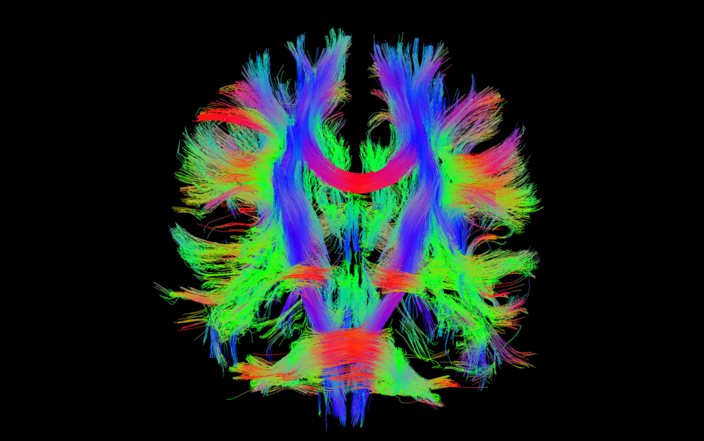 dti_white_matter_tracks