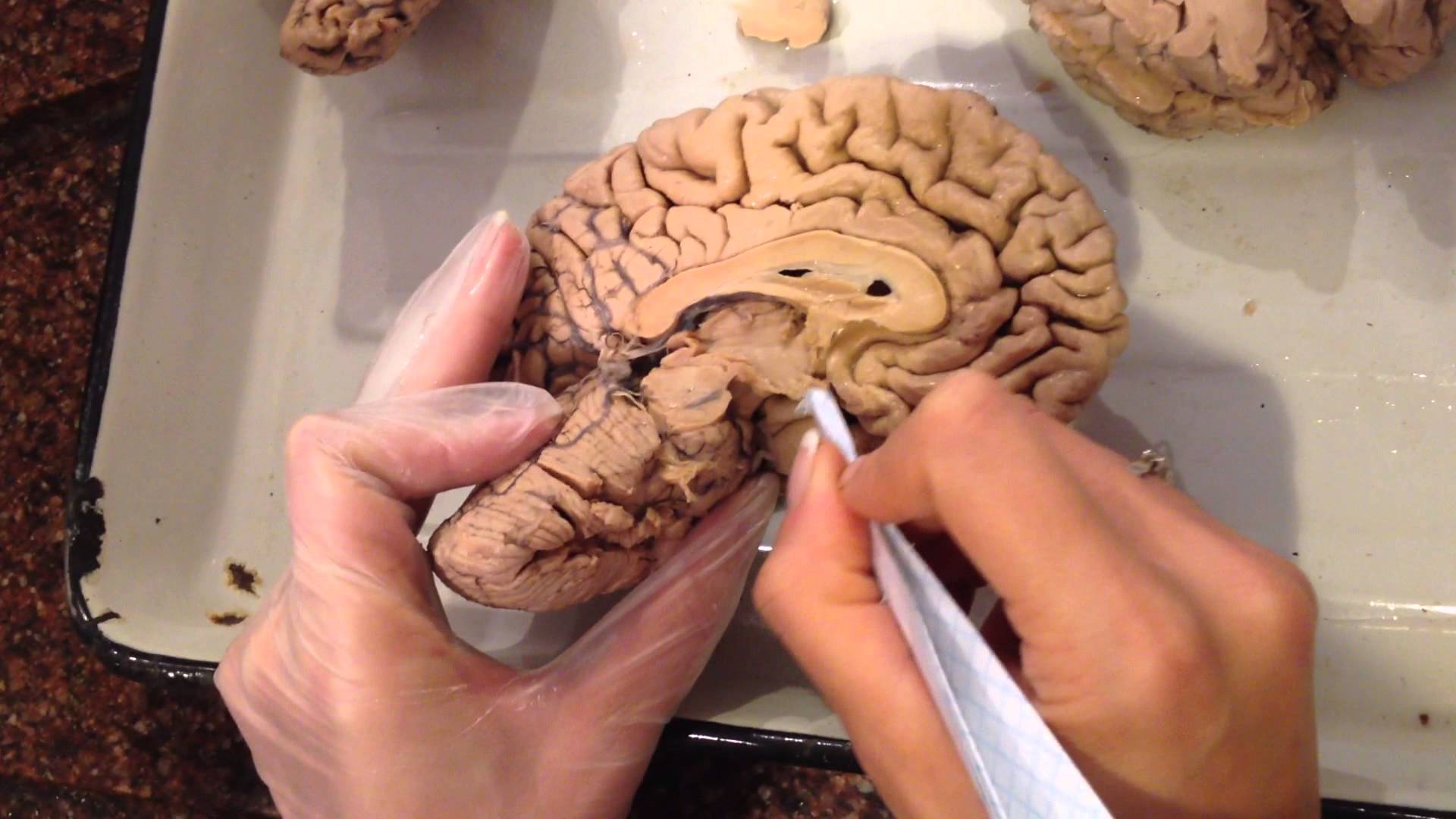 Едят ли мозг человека. Натовщий мозг человека. Настоящий человеческий мозг.
