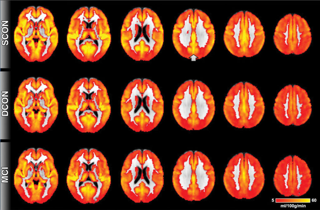 mri