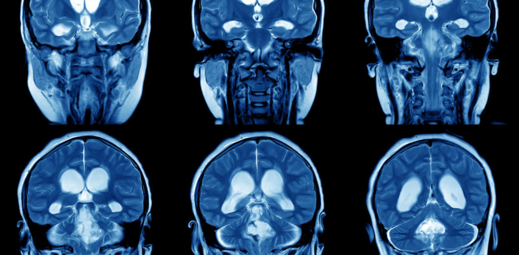 the-brain