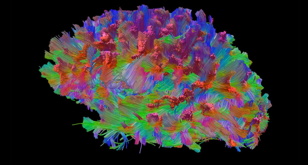 brain