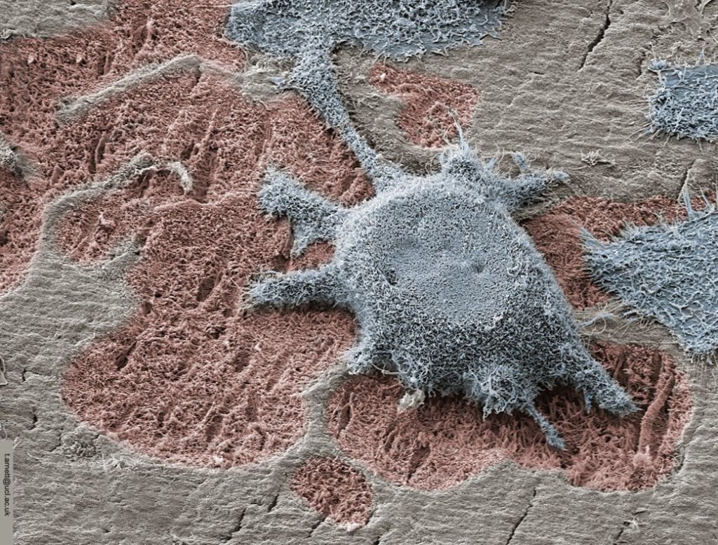 osteoclast_resorption_02