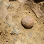 Древнейшие камни в простате обнаружили у мужчины каменного века