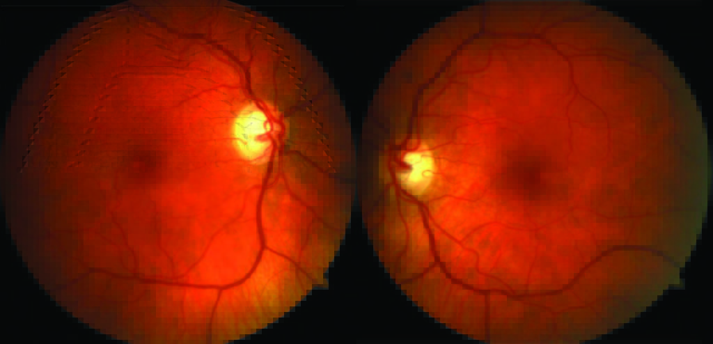 figure1
