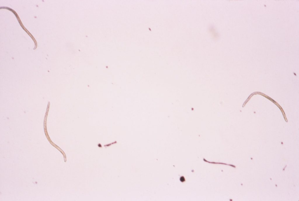 onchocerca_volvulus_01