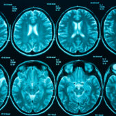 brain-scans-oc-blue