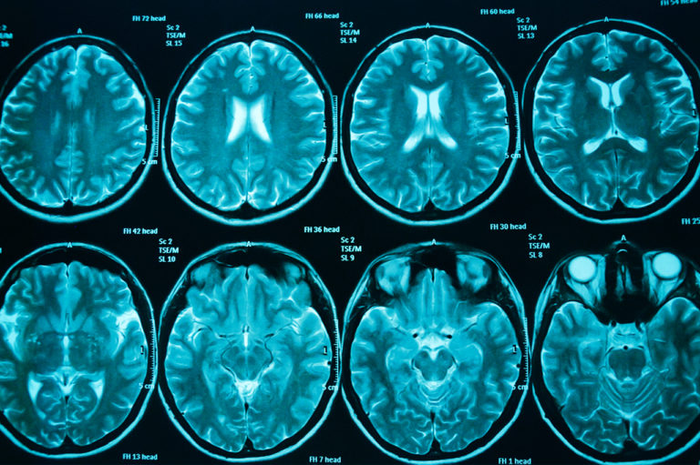 brain-scans-oc-blue