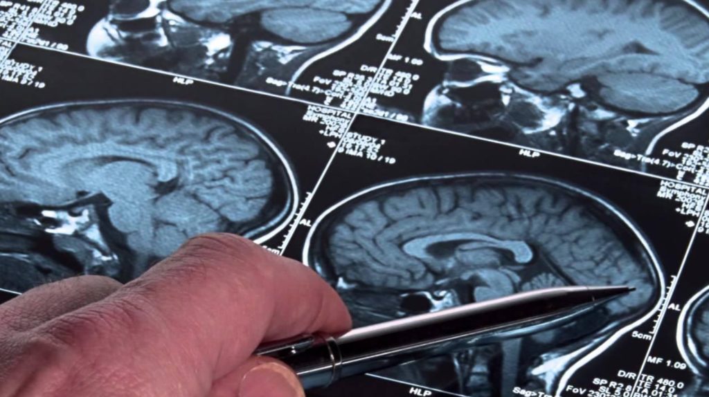 neuropsychology4
