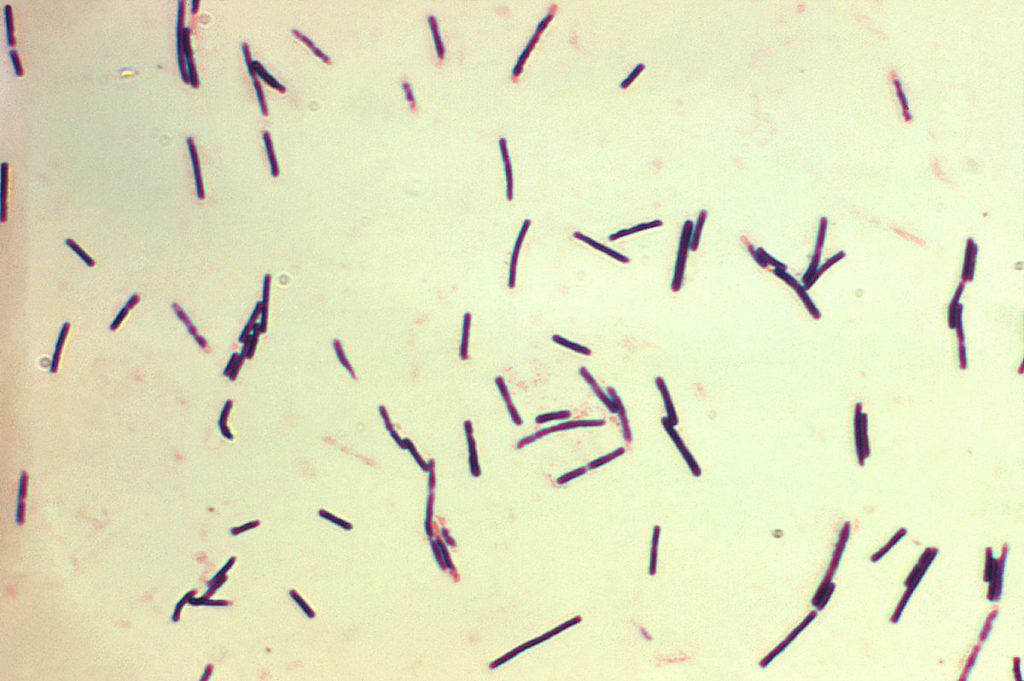 1200px-clostridium_perfringens