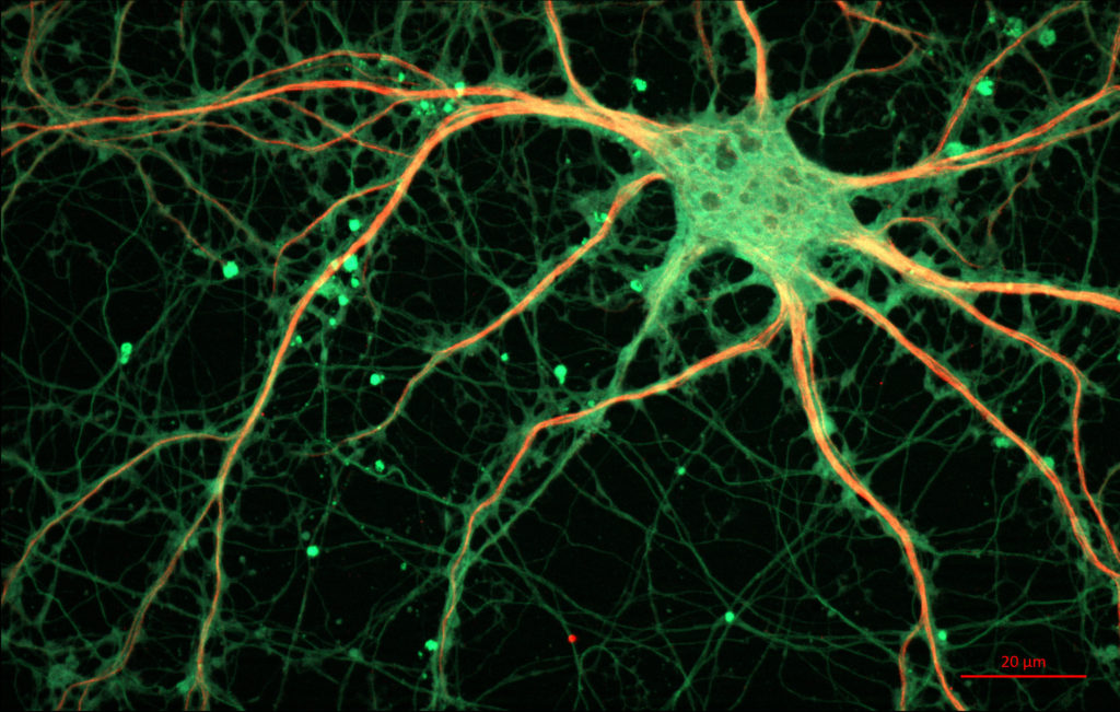 b8_neuron