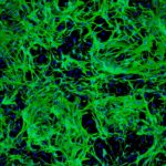Нейроглию превратили в нейроны in vivo