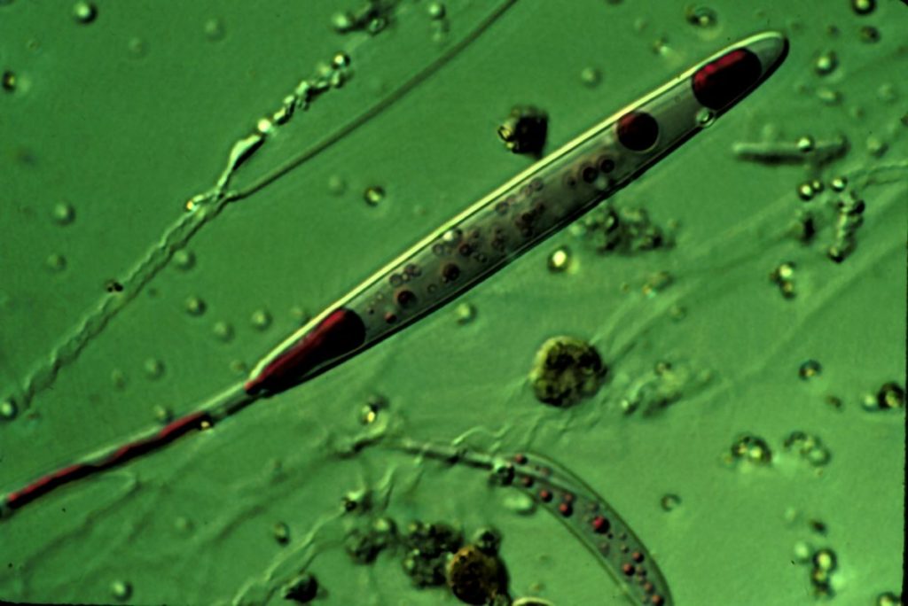 nematocyst0