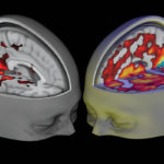 Психоделические препараты стимулируют разнообразие деятельности мозга