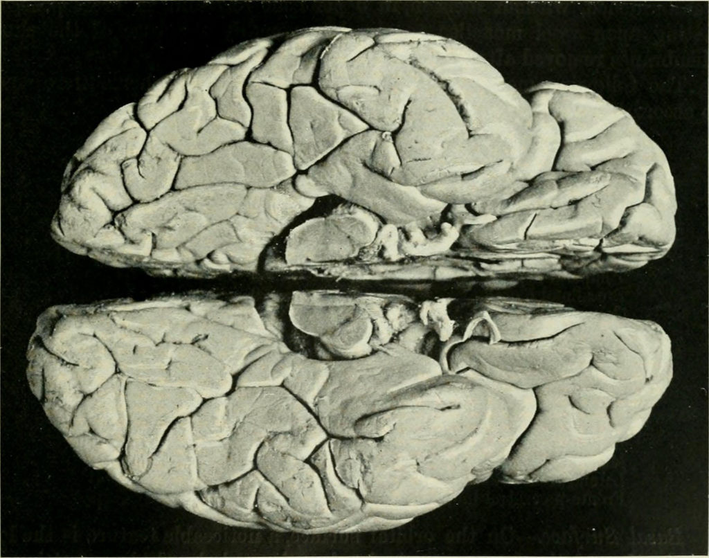 14583986770_e5f9d0d6c4_h
