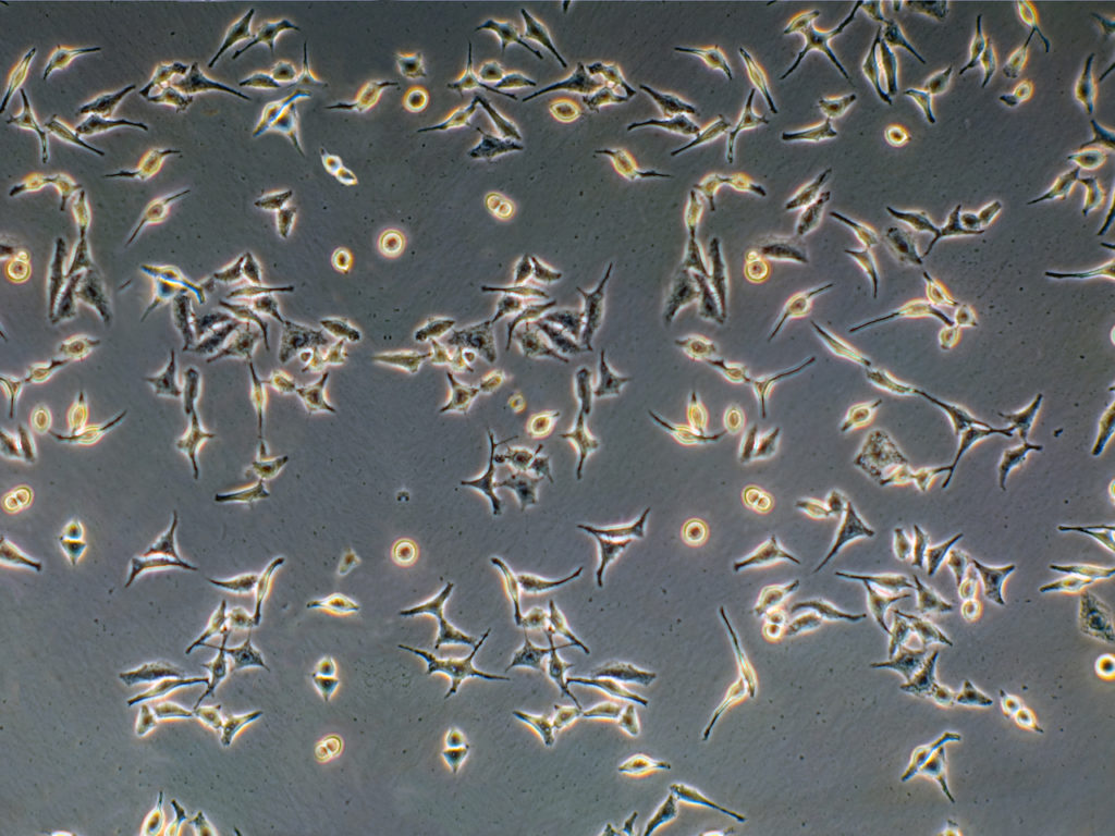 p-162-phase-contrast-light-micrograph-of-prostate-cancer-cells