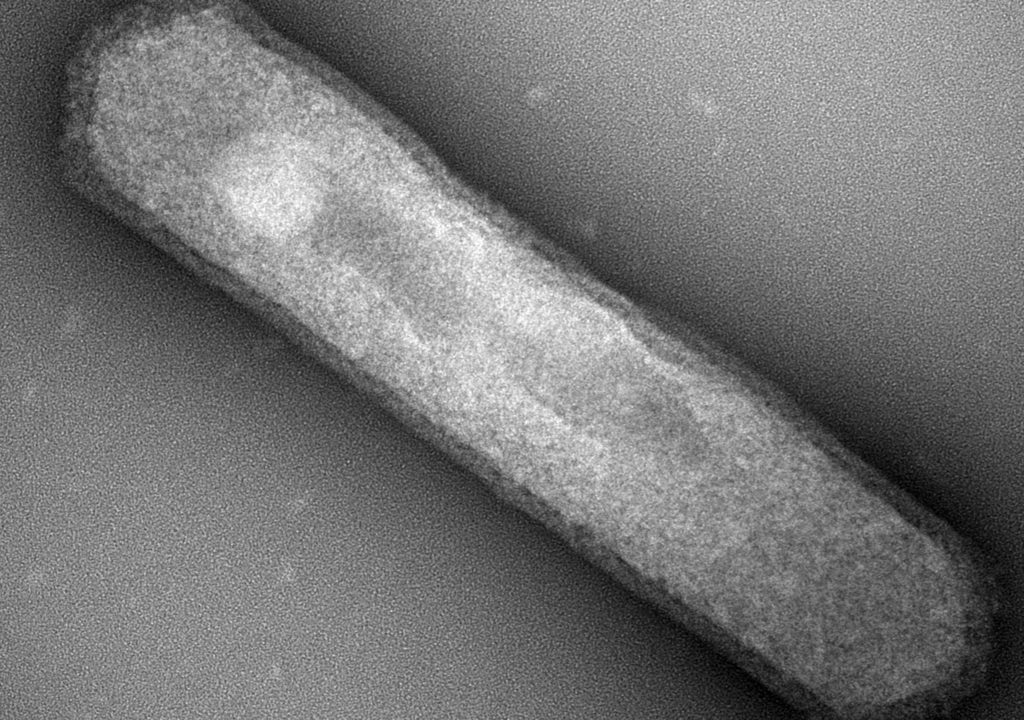 scm-1-20000x-tem
