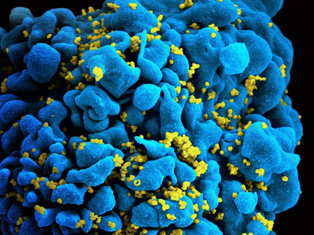 hiv