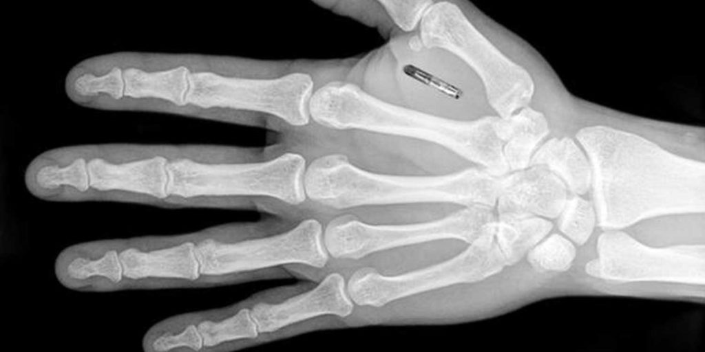 rfid-chip-hand-blog