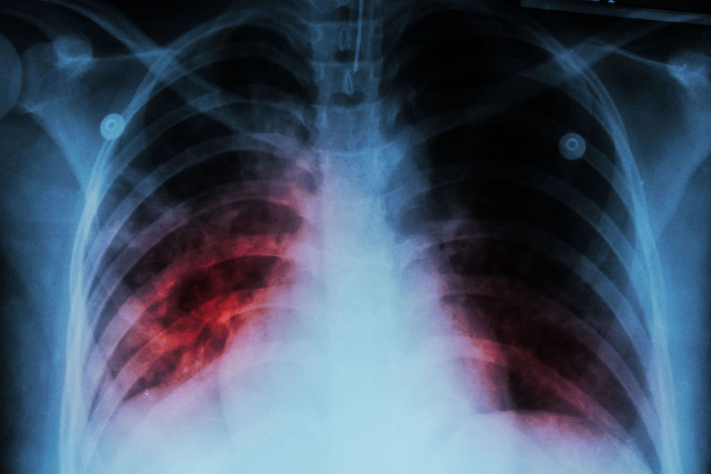 ribcage