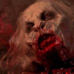 Найдена мутация, вызывающая «болезнь вампиров»