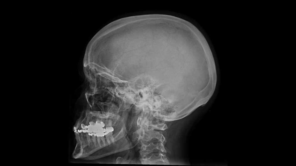 flashpad-skull-clinical