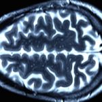 Ученые скрыли смерть пациента с «оживленным» мозгом