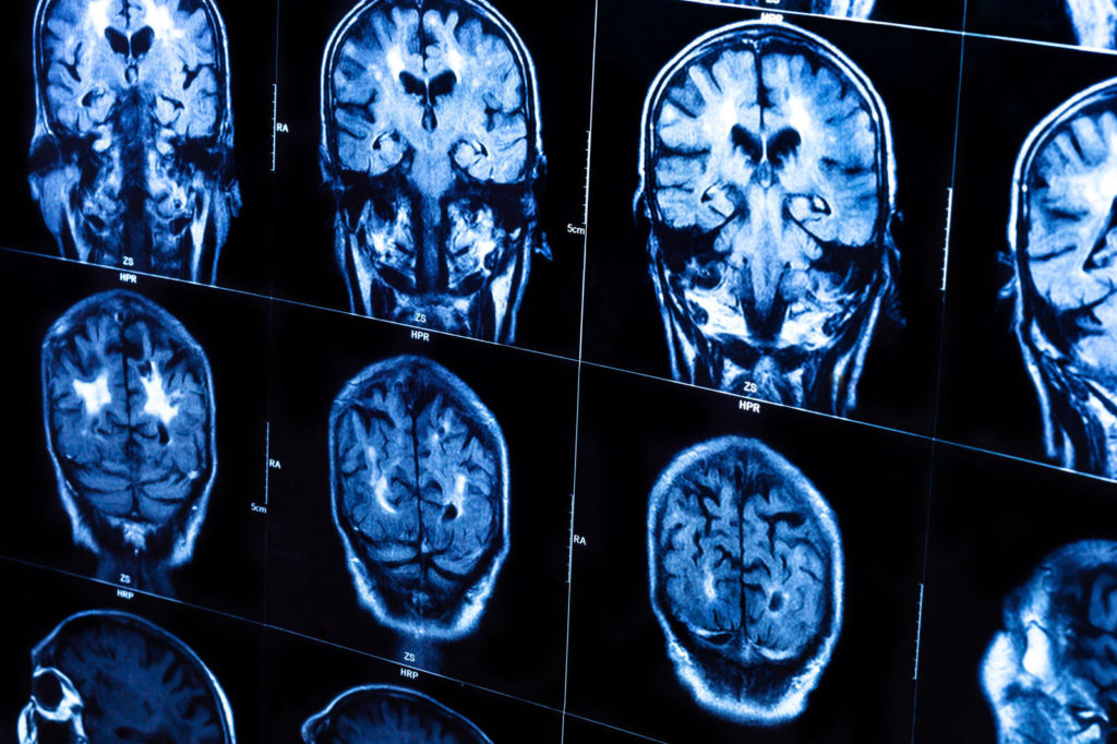 brain