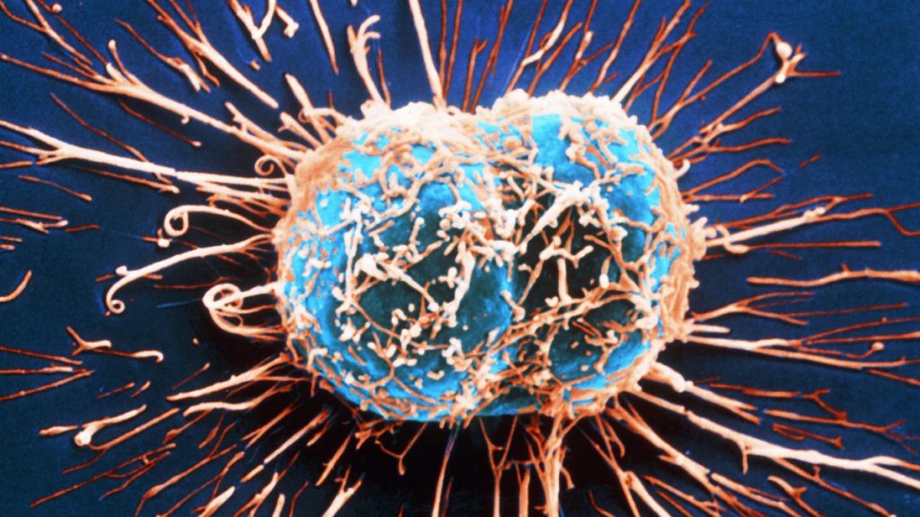 cancercell