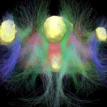 Ученые рассмотрели работу мозга в режиме «автопилота»