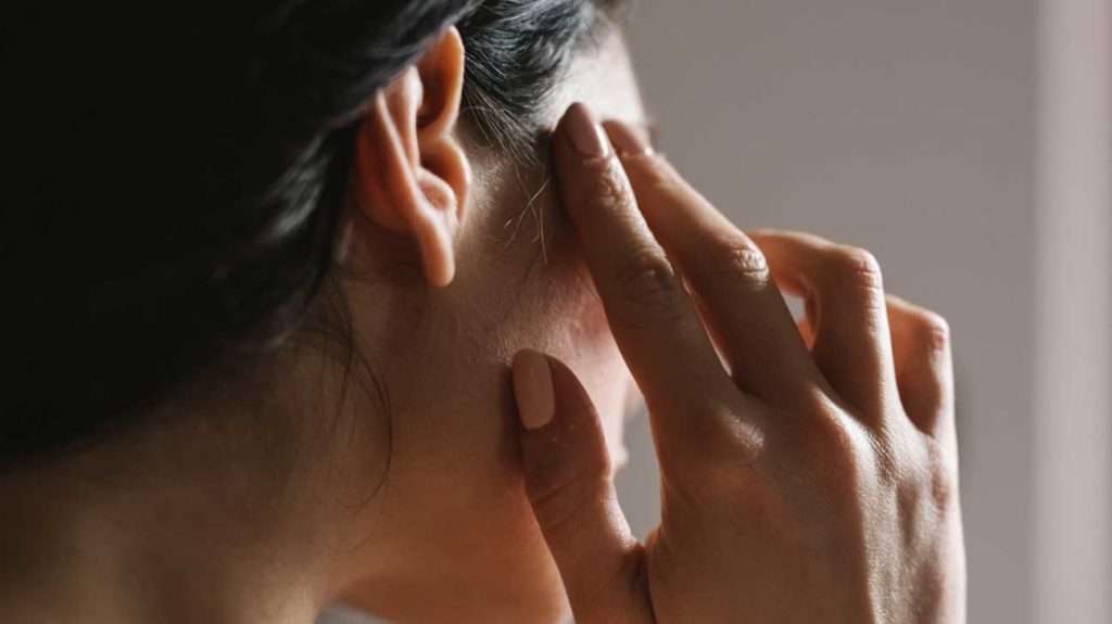 1426_female_migraine_headache_1296x738-header