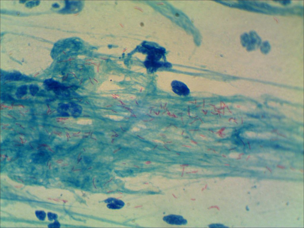 cil-nilsen