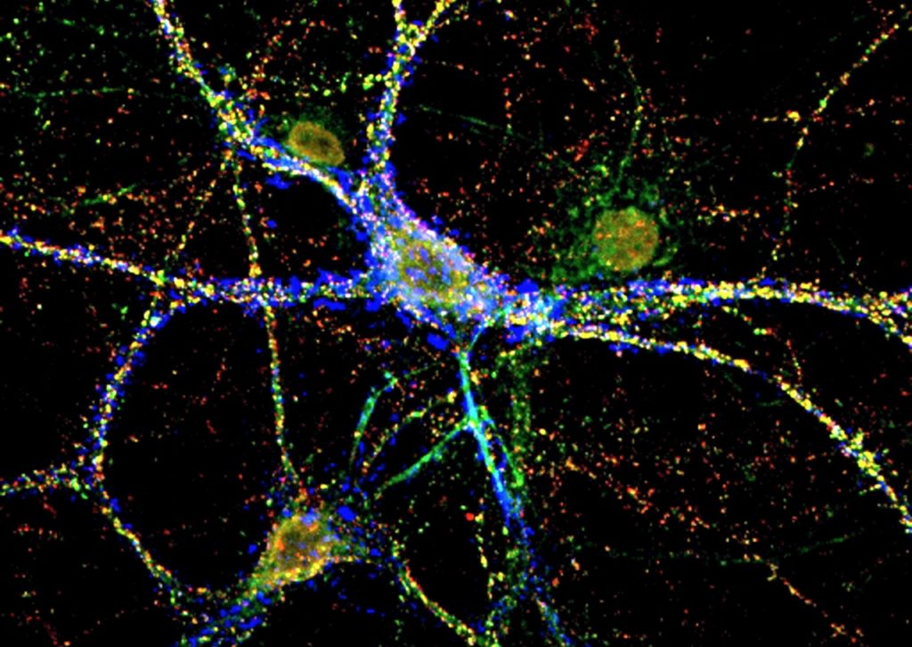 neuro0