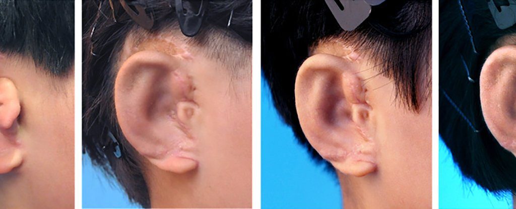 grow-ears-1_1024