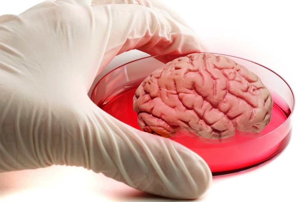 brain0