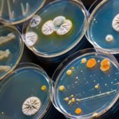 chashki-petri-s-koloniyami-bakteriy