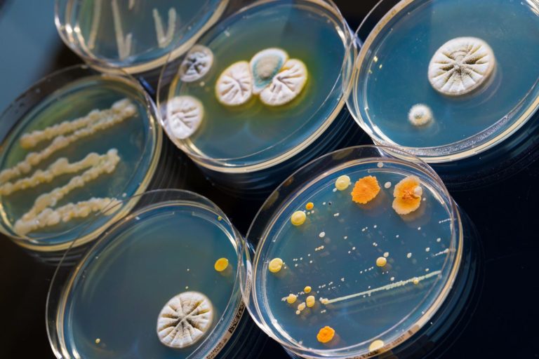 chashki-petri-s-koloniyami-bakteriy