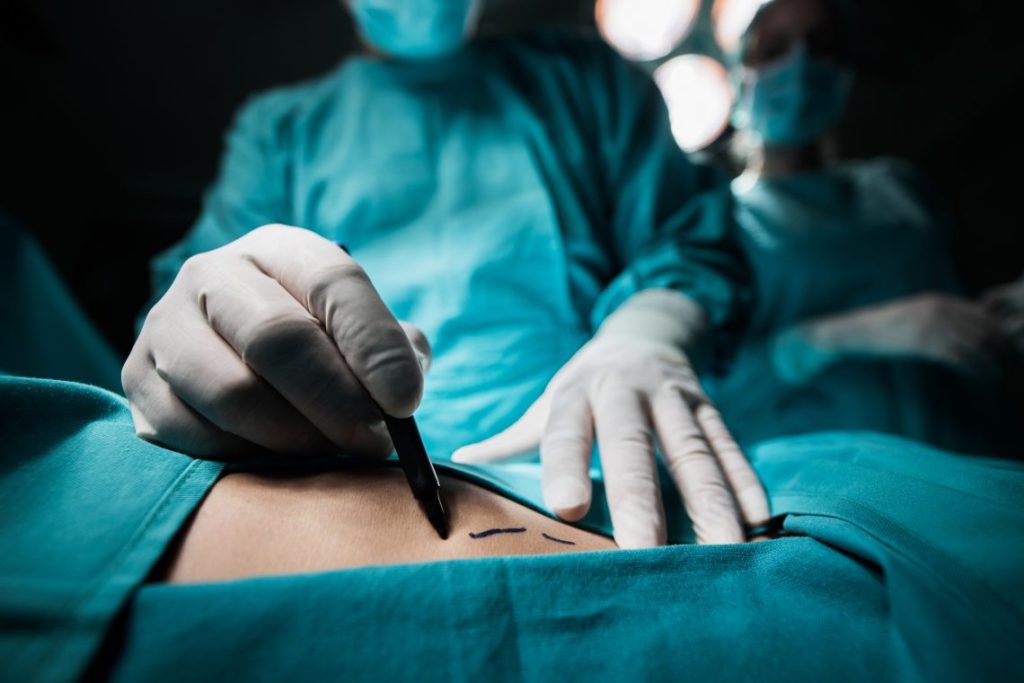 how-much-does-surgery-cost-1140x760