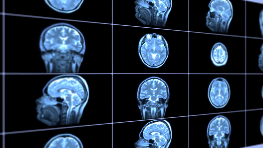 brain0
