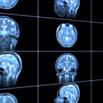 Ученые смогли увидеть пульсацию мозга