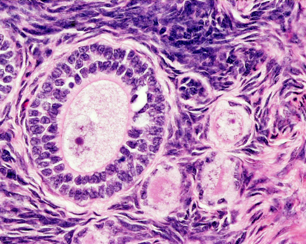 20100530115756monkey-_ovary_primordial_follicle