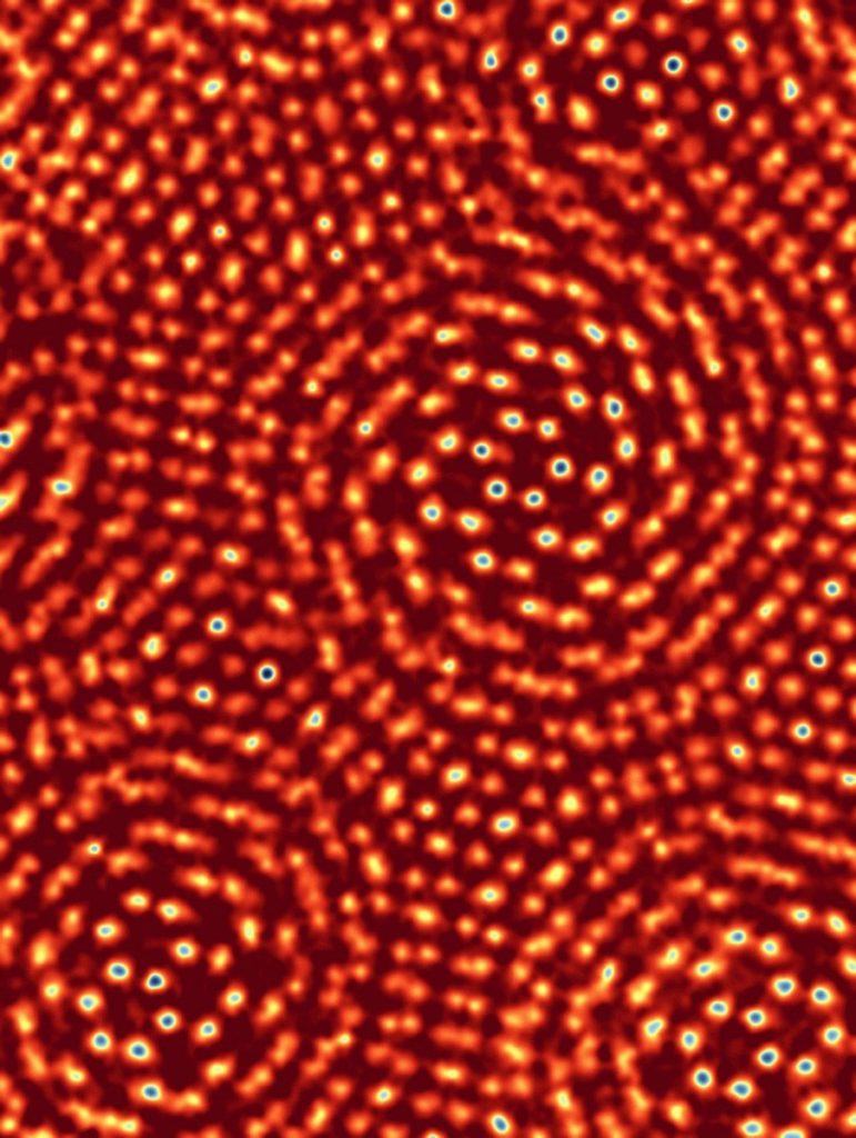 electronmicr1