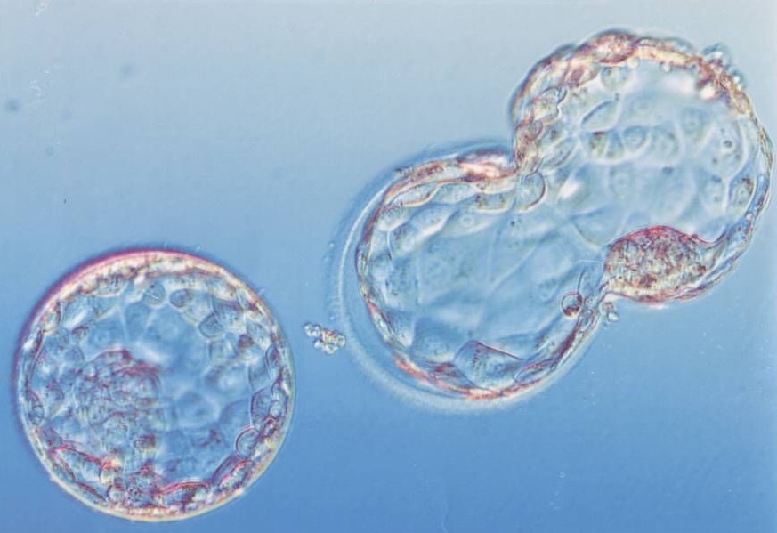 blastocyst0