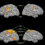 Ученые определили, какие зоны мозга участвуют в составлении и описании историй