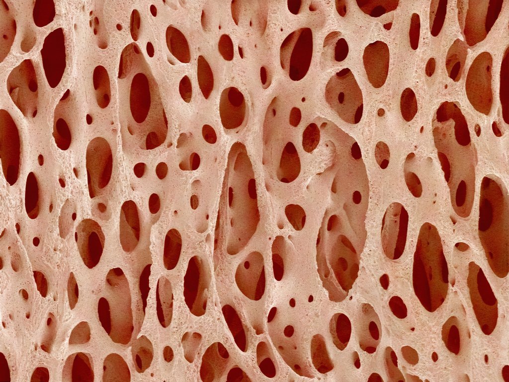 Неприятная ткань. Костная ткань костные клетки. Скелетная костная ткань. Кость это соединительная ткань. Клетки костной соединительной ткани.