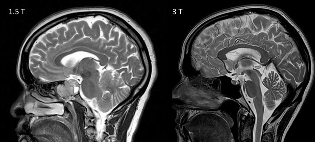 mri1-3