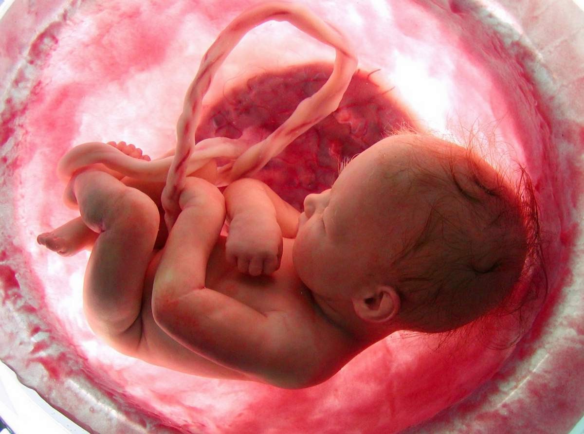 risunok-placenta