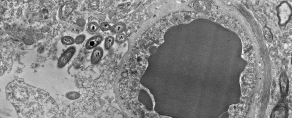 026-human-brain-microbiome-bacteria_1024
