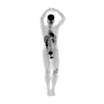 Опубликовано изображение первого сканера всего тела